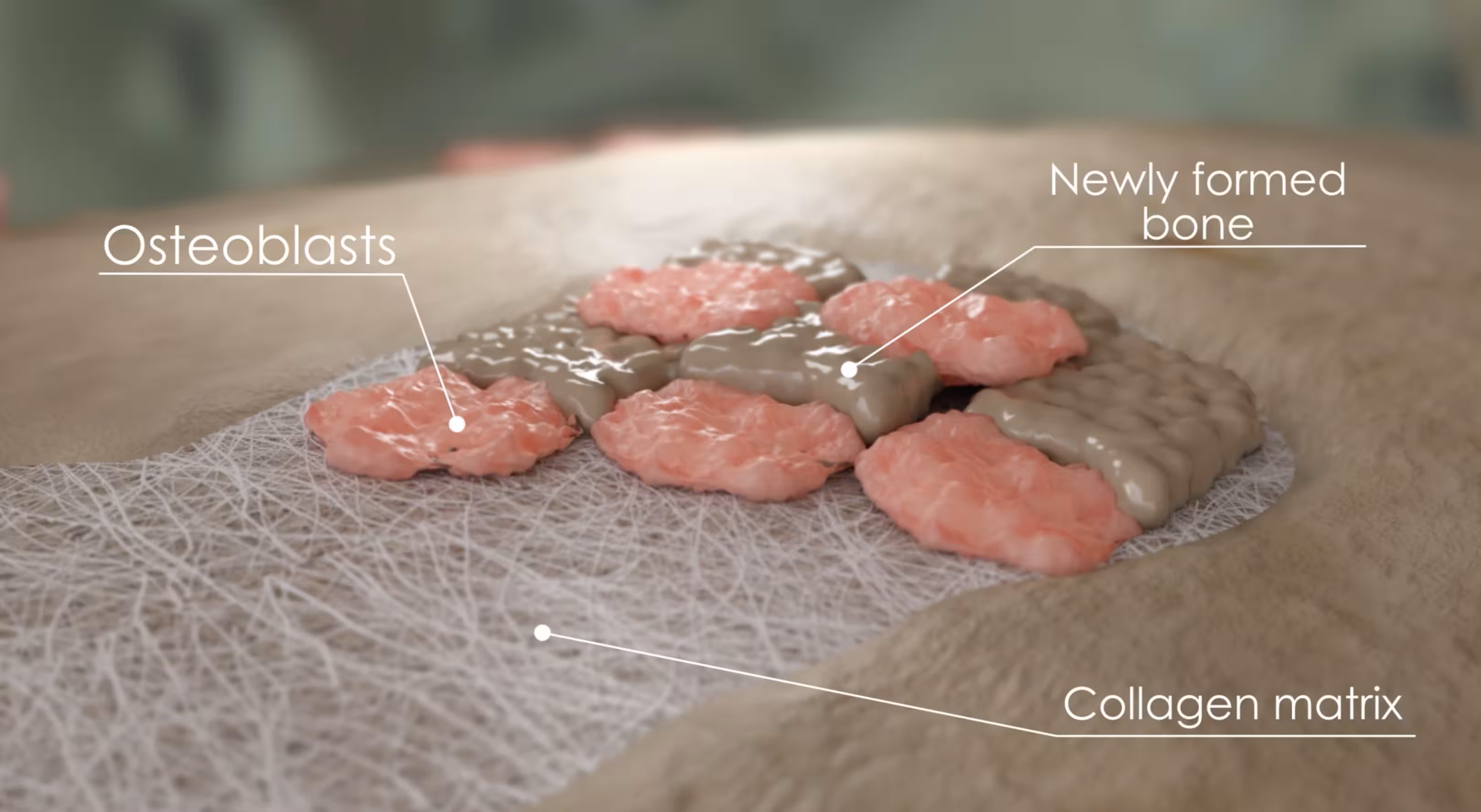 Close-up medical animation of osteoblast cells forming newly developed bone over a collagen matrix scaffold.
